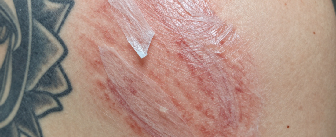 How Long Will a Tattoo Peel? Essential Tips for Tattoo Lovers and Artists